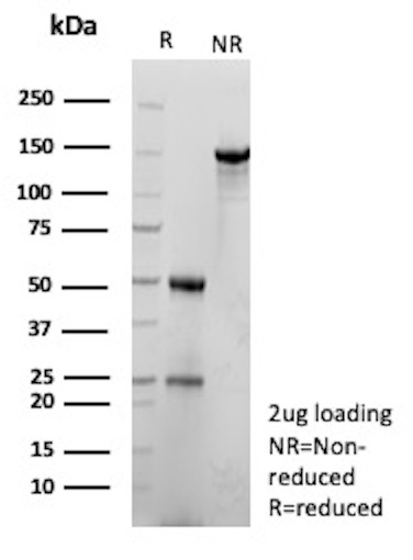 CEACAM1 (CEA Cell Adhesion Molecule 1) Antibody in SDS-PAGE (SDS-PAGE)