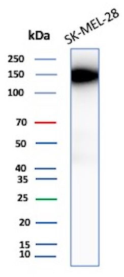 CEACAM1 (CEA Cell Adhesion Molecule 1) Antibody in Western Blot (WB)