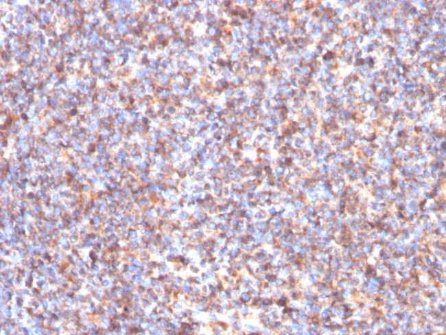 SDHB (Succinate Dehydrogenase B) (Pheochromocytoma Marker) Antibody in Immunohistochemistry (Paraffin) (IHC (P))
