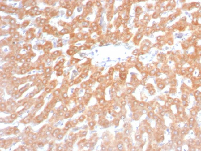 SDHB (Succinate Dehydrogenase B) (Pheochromocytoma Marker) Antibody in Immunohistochemistry (Paraffin) (IHC (P))