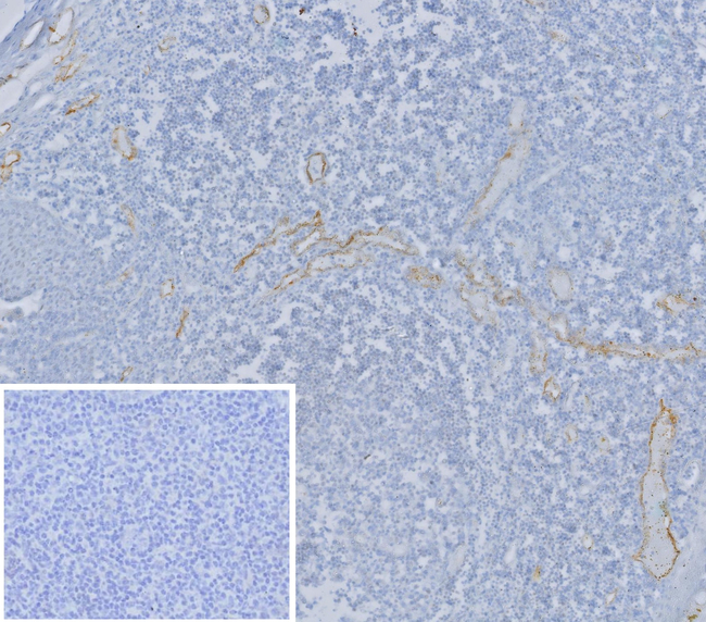 CD62E/Selectin E (SELE)/ELAM-1 Antibody in Immunohistochemistry (Paraffin) (IHC (P))