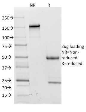 CD62L (L-Selectin) Antibody in SDS-PAGE (SDS-PAGE)