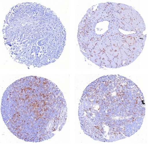 CD162 (Selectin P Ligand) Antibody in Immunohistochemistry (Paraffin) (IHC (P))