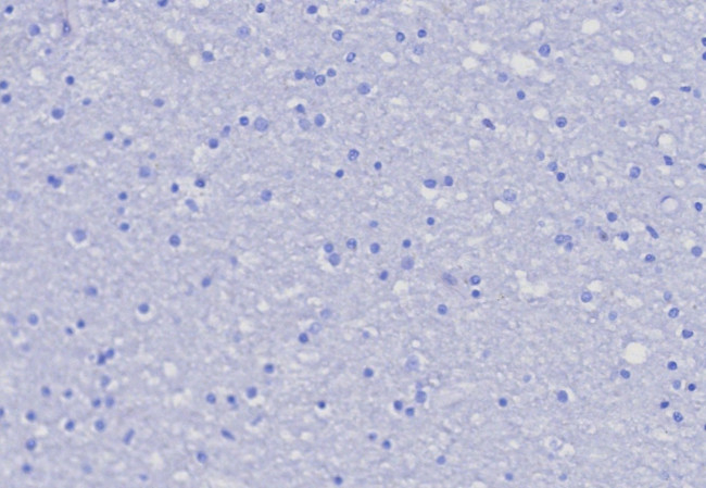CD162 (Selectin P Ligand) Antibody in Immunohistochemistry (Paraffin) (IHC (P))