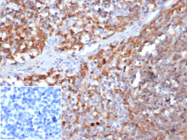 Gamma-parvin Antibody in Immunohistochemistry (Paraffin) (IHC (P))
