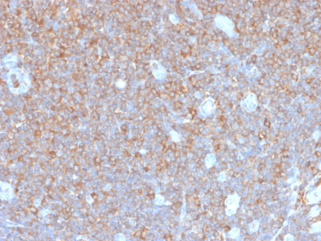 Gamma-parvin (PARVG) Antibody in Immunohistochemistry (Paraffin) (IHC (P))