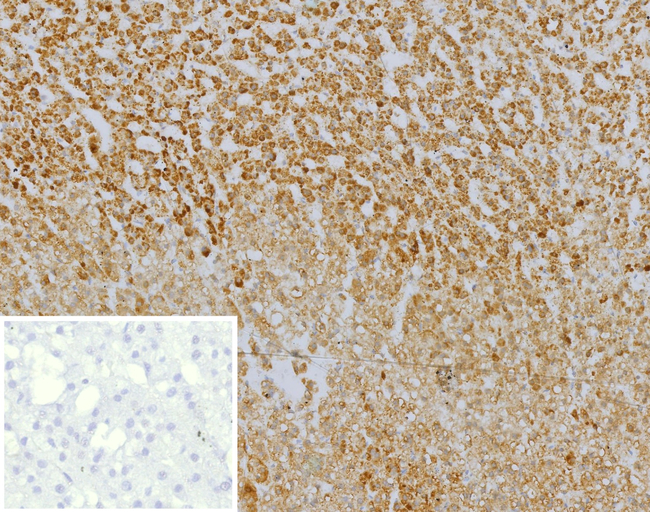 CXCR5 (Marker of T Follicular Helper (Tfh) Cells) Antibody in Immunohistochemistry (Paraffin) (IHC (P))
