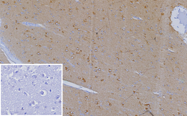 CXCR5 (Marker of T Follicular Helper (Tfh) Cells) Antibody in Immunohistochemistry (Paraffin) (IHC (P))