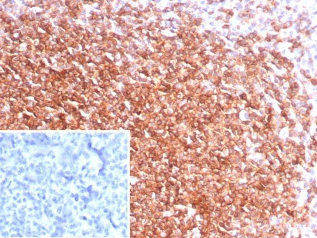 CXCR5/CXCL13/CD185 Antibody in Immunohistochemistry (Paraffin) (IHC (P))
