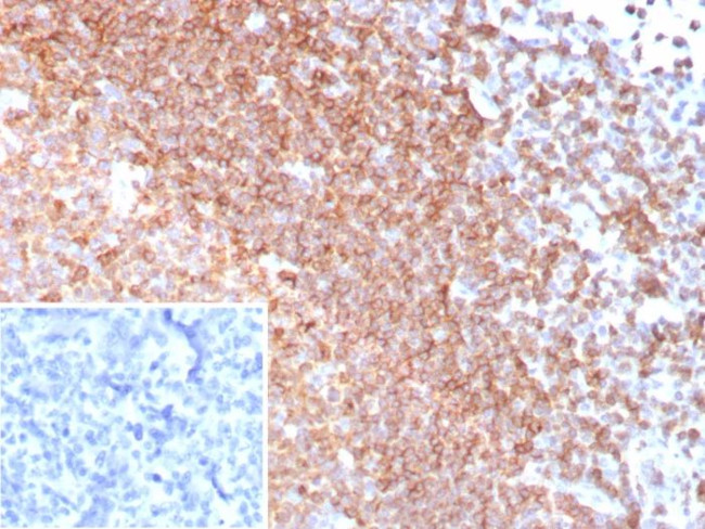CXCR5/CXCL13/CD185 Antibody in Immunohistochemistry (Paraffin) (IHC (P))