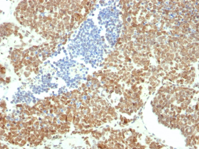 BMI1 Antibody in Immunohistochemistry (Paraffin) (IHC (P))