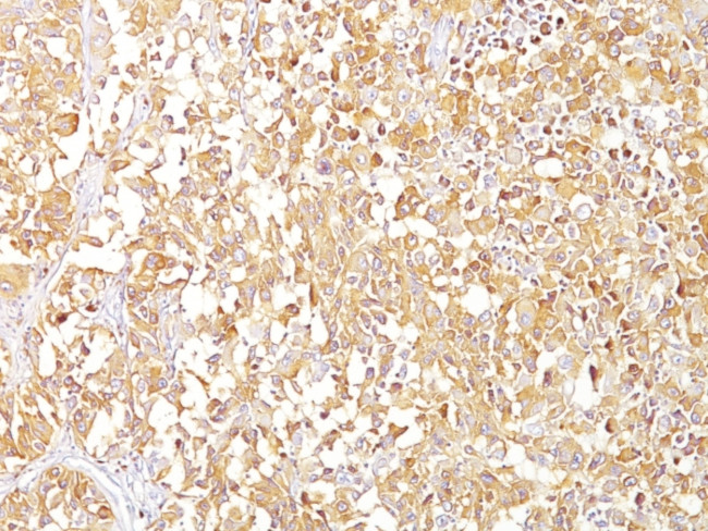 gp100/Melanosome/PMEL17/SILV (Melanoma Marker) Antibody in Immunohistochemistry (Paraffin) (IHC (P))