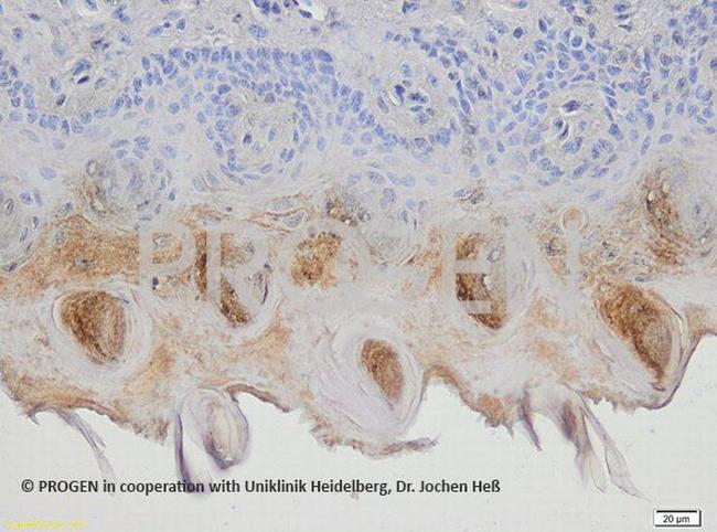Ep-CAM Antibody in Immunohistochemistry (IHC)