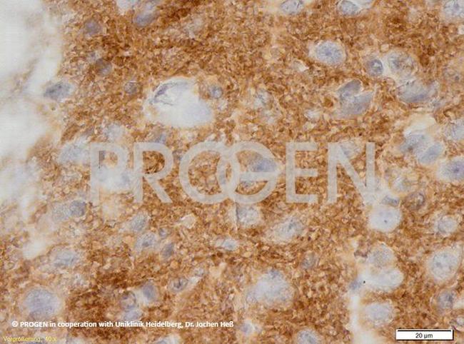 Synaptophysin Antibody in Immunohistochemistry (IHC)