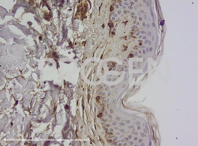 Vimentin Antibody in Immunohistochemistry (IHC)