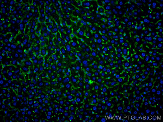 CD105 Antibody in Immunohistochemistry (Paraffin) (IHC (P))