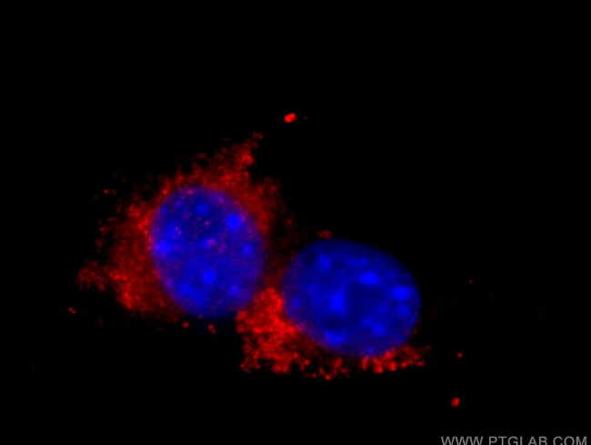 CD107a/LAMP1 Antibody in Immunocytochemistry (ICC/IF)