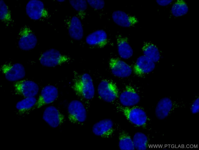 CD107a Antibody in Immunocytochemistry (ICC/IF)