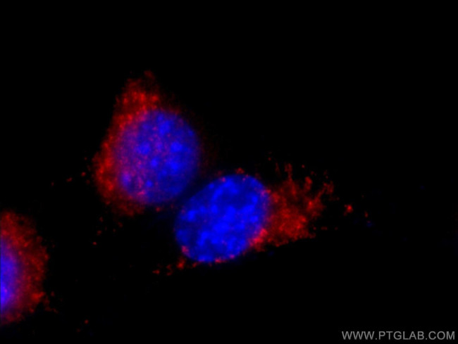 CD107b/LAMP2 Antibody in Immunocytochemistry (ICC/IF)