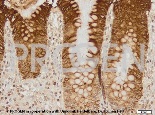 Cytokeratin 20 Antibody in Immunohistochemistry (IHC)