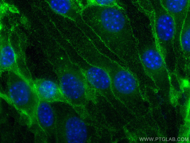 CD31 Antibody in Immunocytochemistry (ICC/IF)