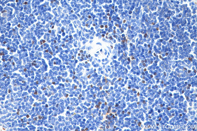 Foxp3 Antibody in Immunohistochemistry (Paraffin) (IHC (P))