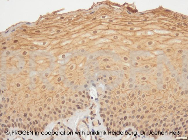 Desmoglein 1 Antibody in Immunohistochemistry (IHC)