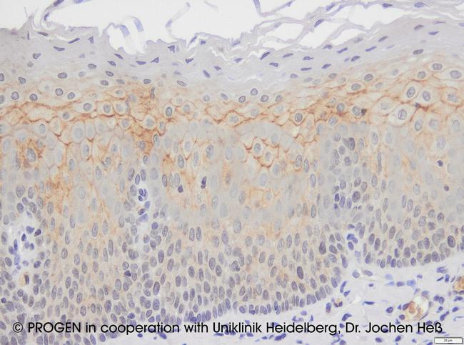 Desmoglein 3 Antibody in Immunohistochemistry (IHC)