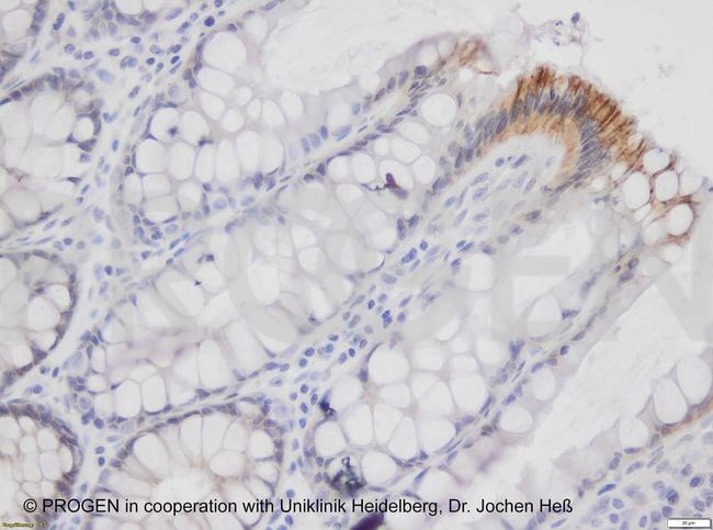 Desmoglein 2 Antibody in Immunohistochemistry (IHC)