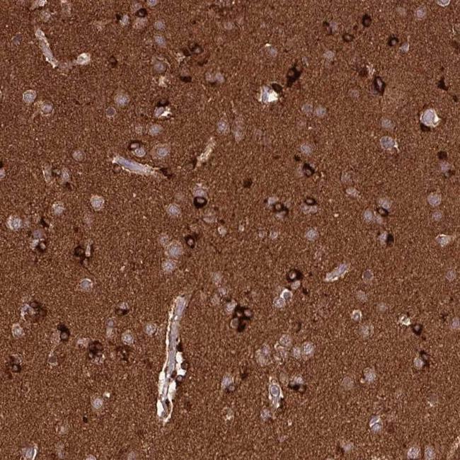 delta Catenin Antibody in Immunohistochemistry (IHC)