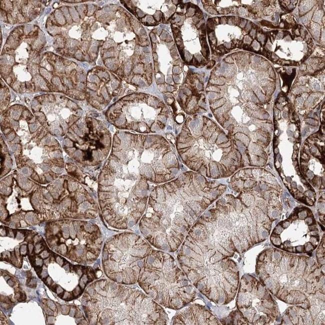 p0071 Antibody in Immunohistochemistry (IHC)