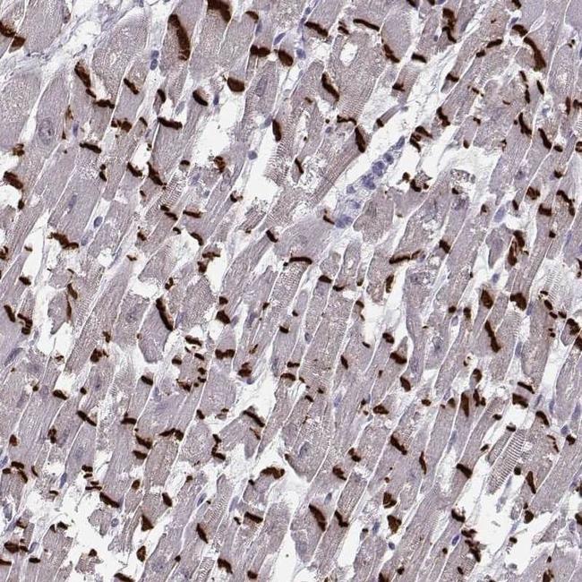 Plakophilin 2 Antibody in Immunohistochemistry (IHC)
