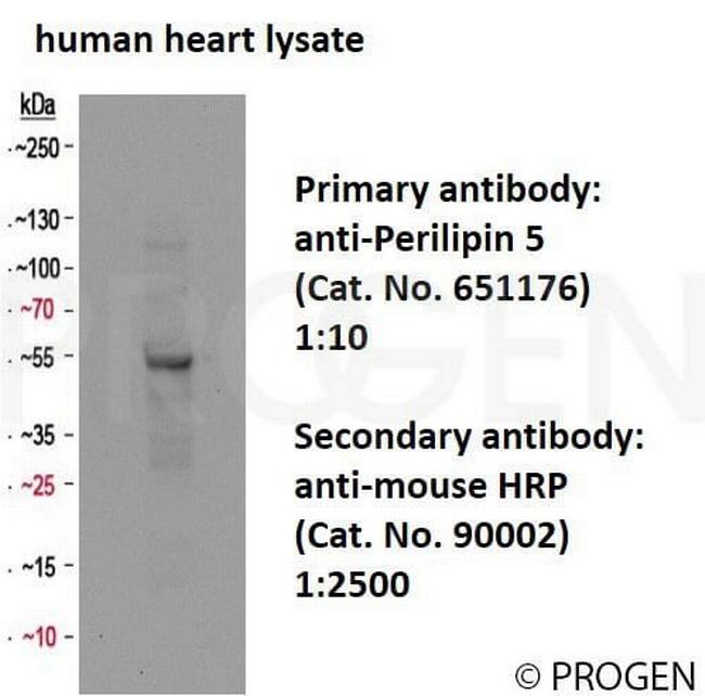 MLDP/PLIN5 Antibody in Western Blot (WB)