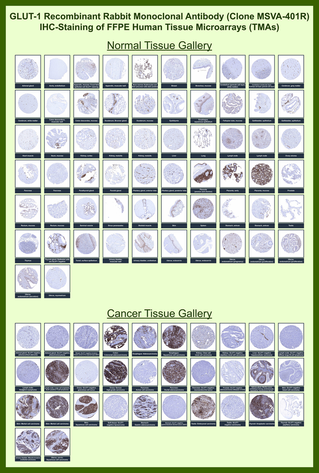 GLUT-1 (Tumor Progression and Mesothelioma Marker) Antibody in Immunohistochemistry (Paraffin) (IHC (P))