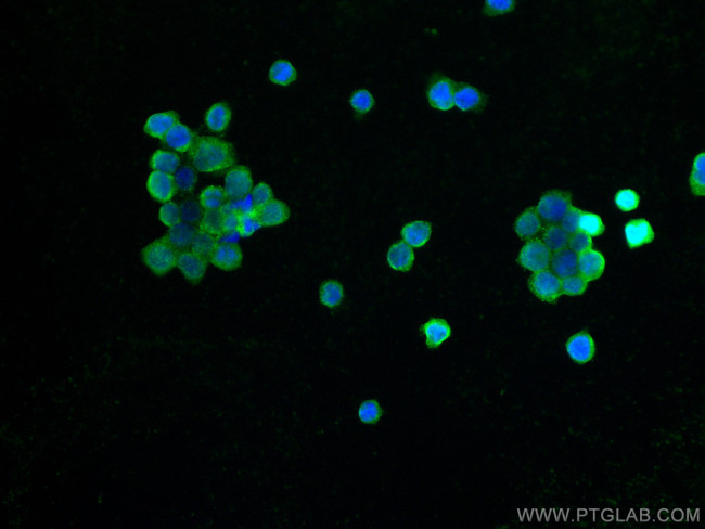 CD68 Antibody in Immunocytochemistry (ICC/IF)