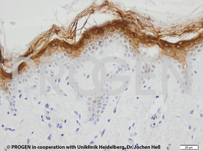 KRT2 Antibody in Immunohistochemistry (IHC)