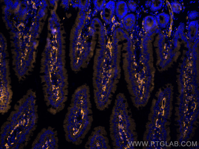 PLVAP Antibody in Immunohistochemistry (PFA fixed) (IHC (PFA))