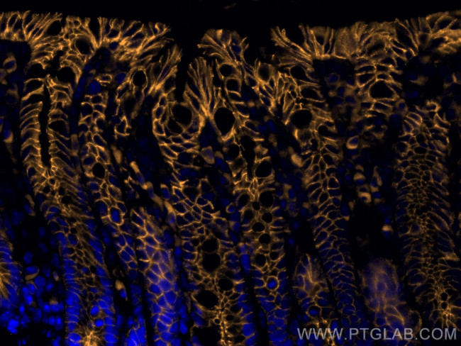 CD324 (E-cadherin) Antibody in Immunohistochemistry (PFA fixed) (IHC (PFA))