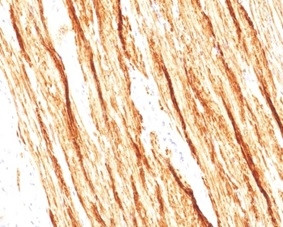 Smoothelin (Differentiated Smooth Muscle Marker) Antibody in Immunohistochemistry (Paraffin) (IHC (P))