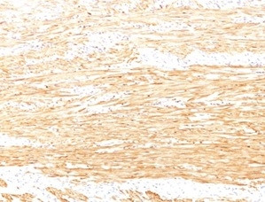 Smoothelin (Differentiated Smooth Muscle Marker) Antibody in Immunohistochemistry (Paraffin) (IHC (P))