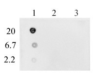 DNA-RNA Hybrid Antibody in Dot Blot (DB)