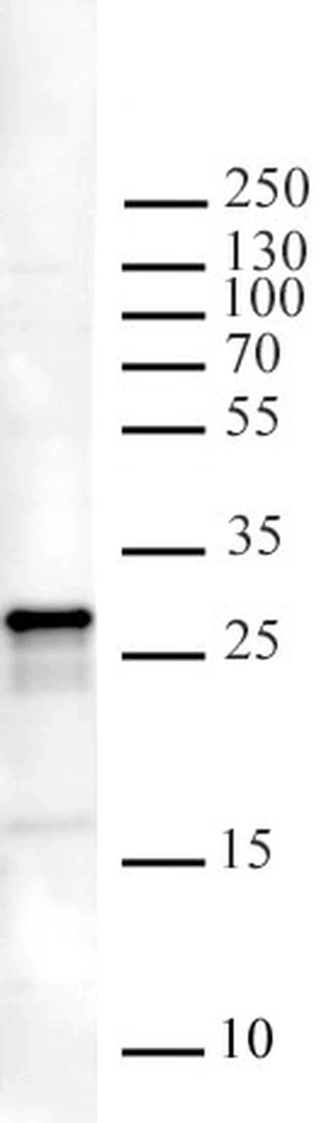 ING5 Antibody in Western Blot (WB)