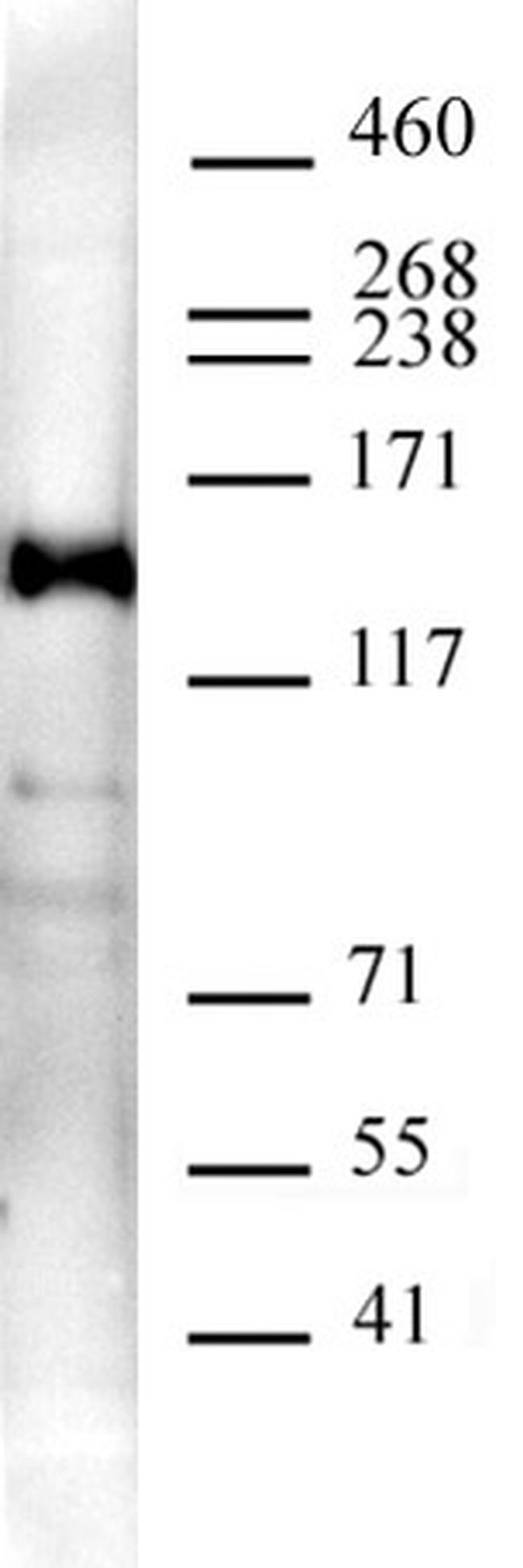 Supt5H/SPT5 Antibody in Western Blot (WB)