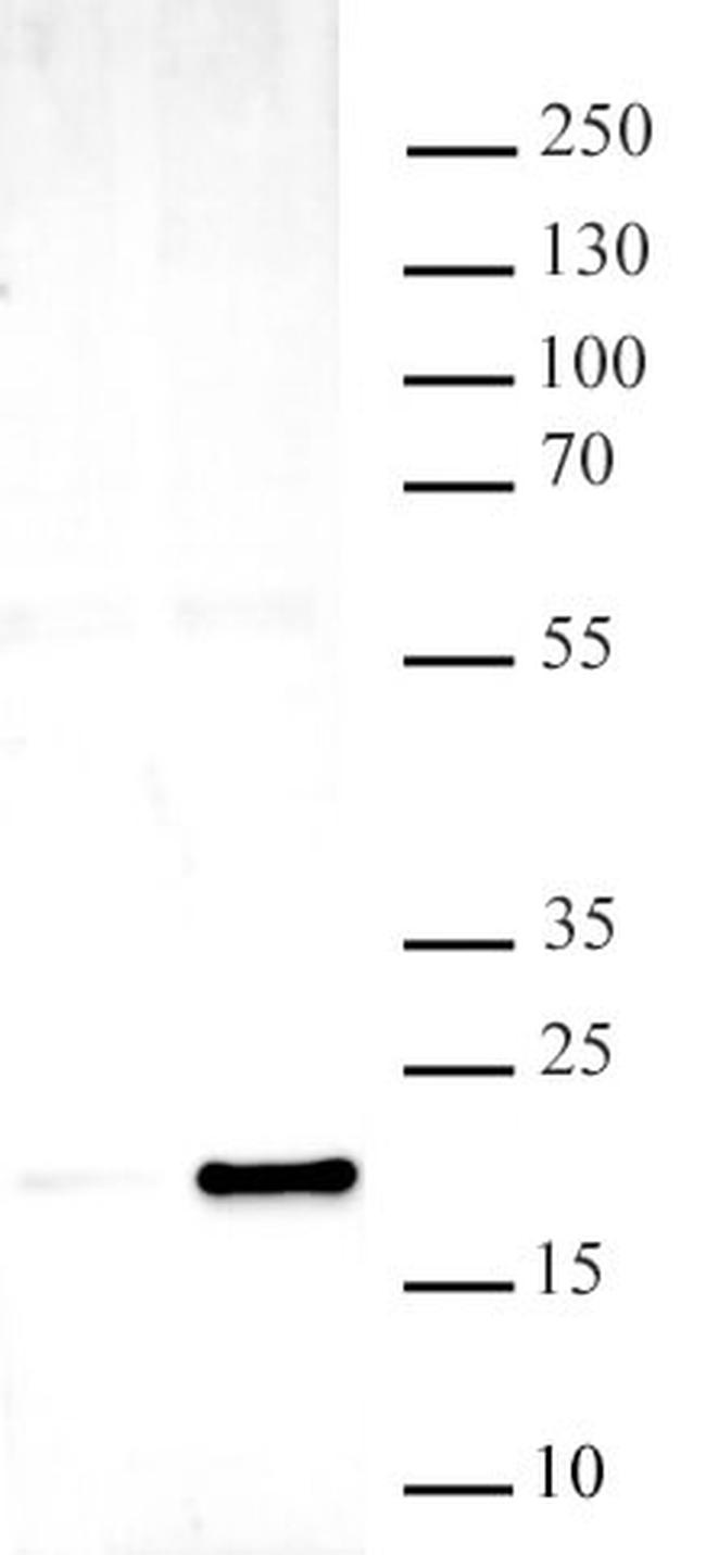 Histone H3K14ac Antibody in Western Blot (WB)