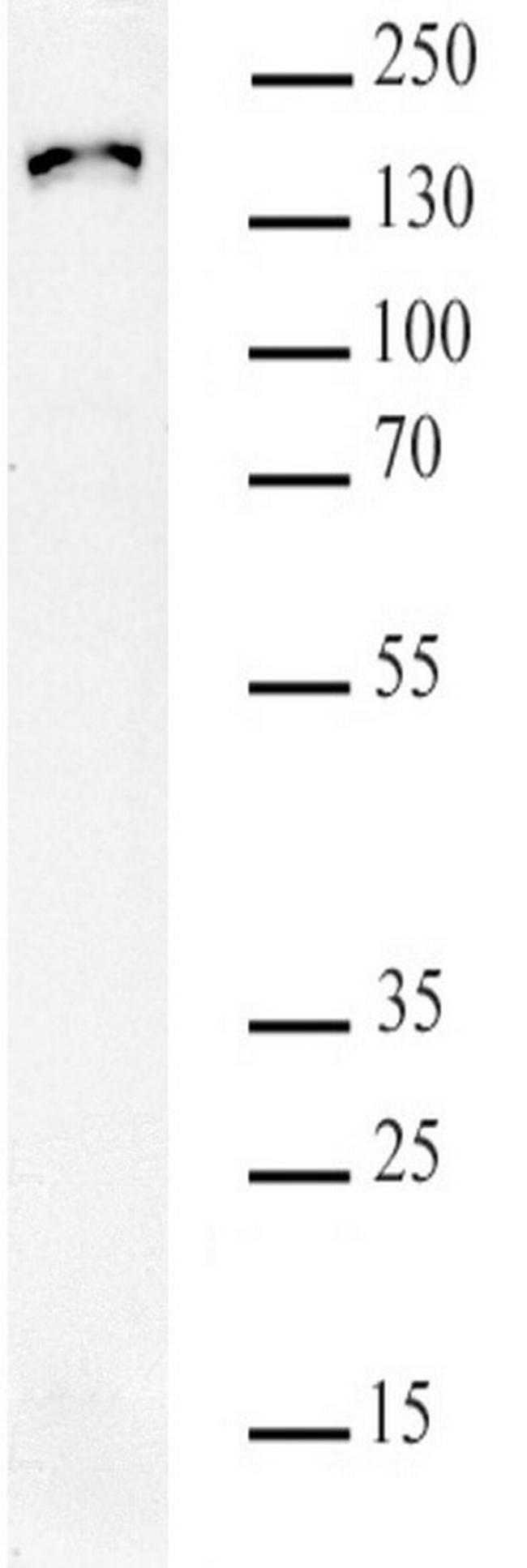 SMC3 K105acK106ac Antibody in Western Blot (WB)
