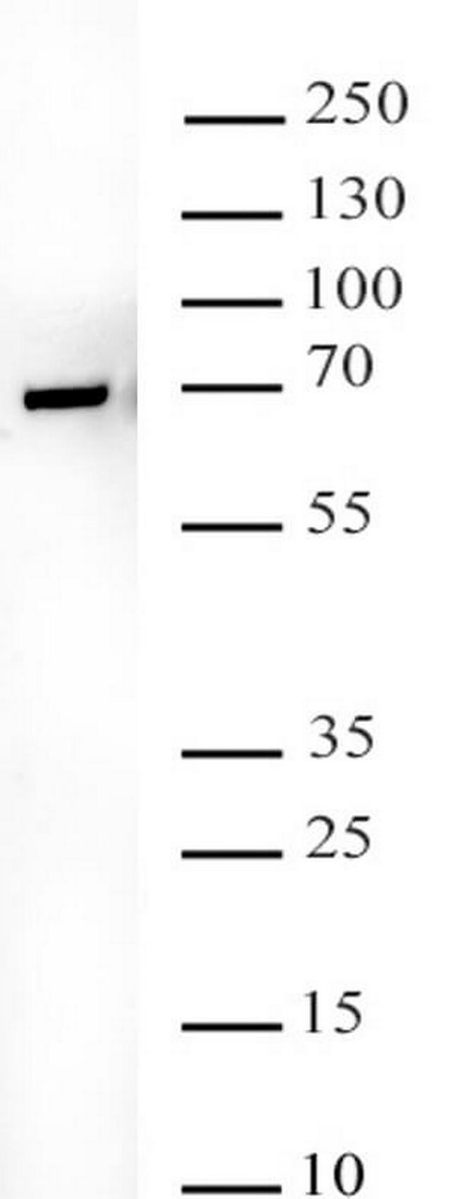 YTHDF2 Antibody in Western Blot (WB)