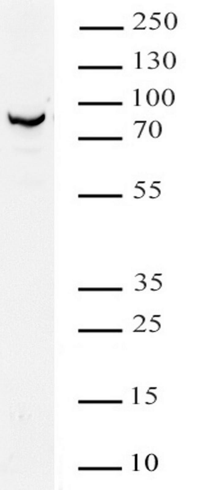METTL16 Antibody in Western Blot (WB)