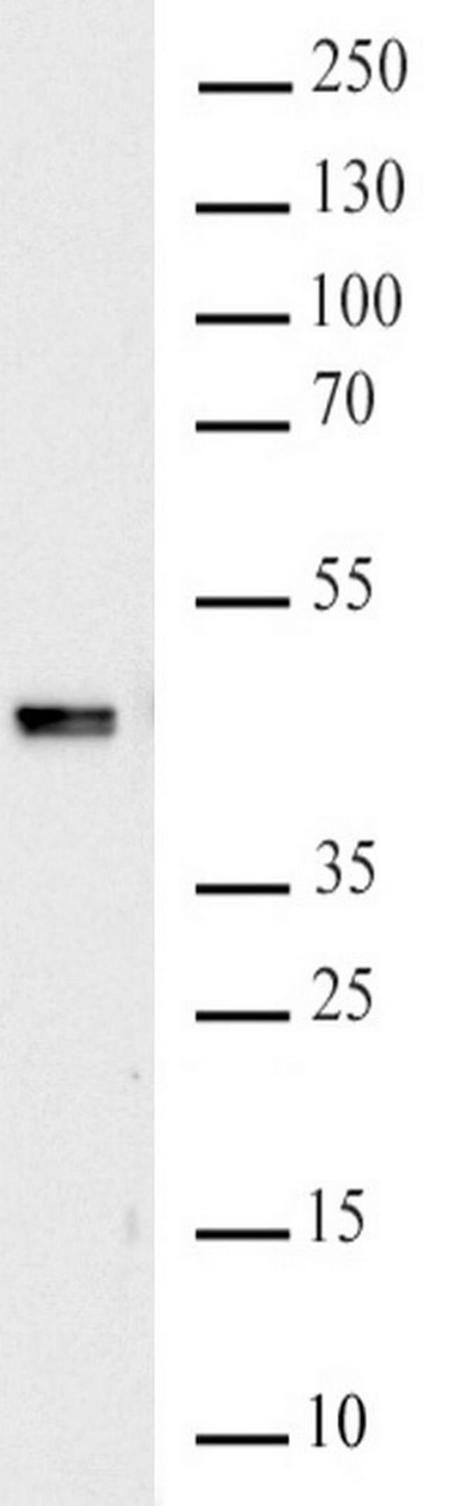 HNRPC Antibody in Western Blot (WB)