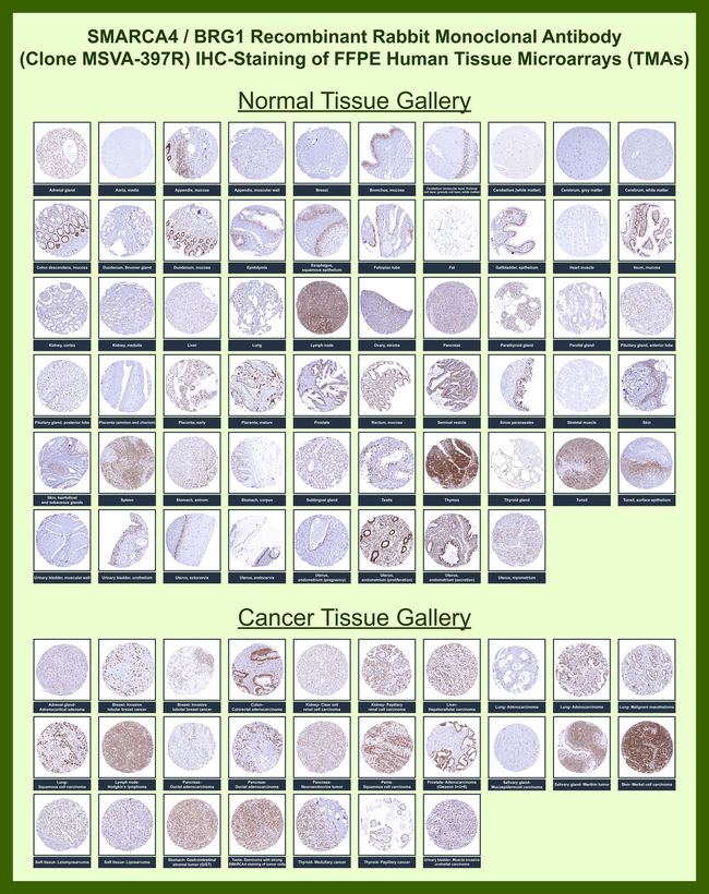 BRG1/SMARCA4 Antibody in Immunohistochemistry (Paraffin) (IHC (P))