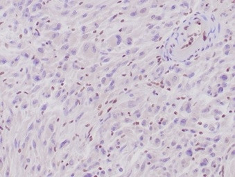 Integrase interactor 1 (INI-1)/SNF5/SMARCB1 Antibody in Immunohistochemistry (Paraffin) (IHC (P))